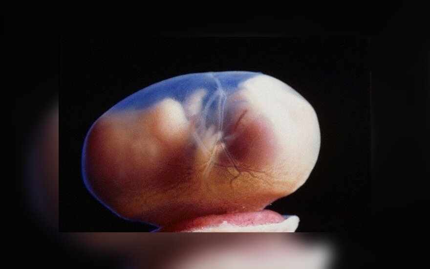 Сейм озадачен: одновременно проголосовали за замораживание эмбрионов и запрет на это