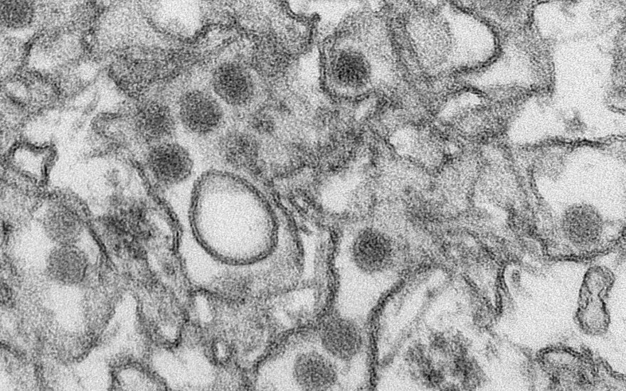 Zika virusas