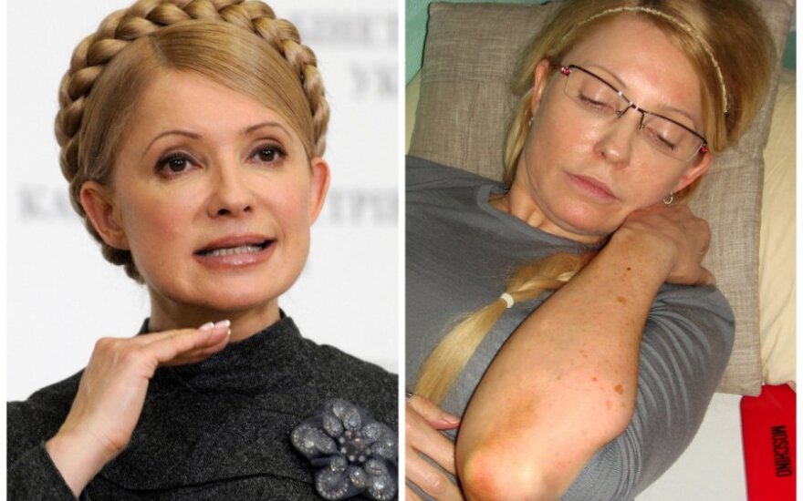 ЕС пришлет дополнительных врачей для лечения Тимошенко