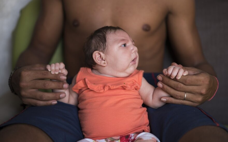 Zika virus