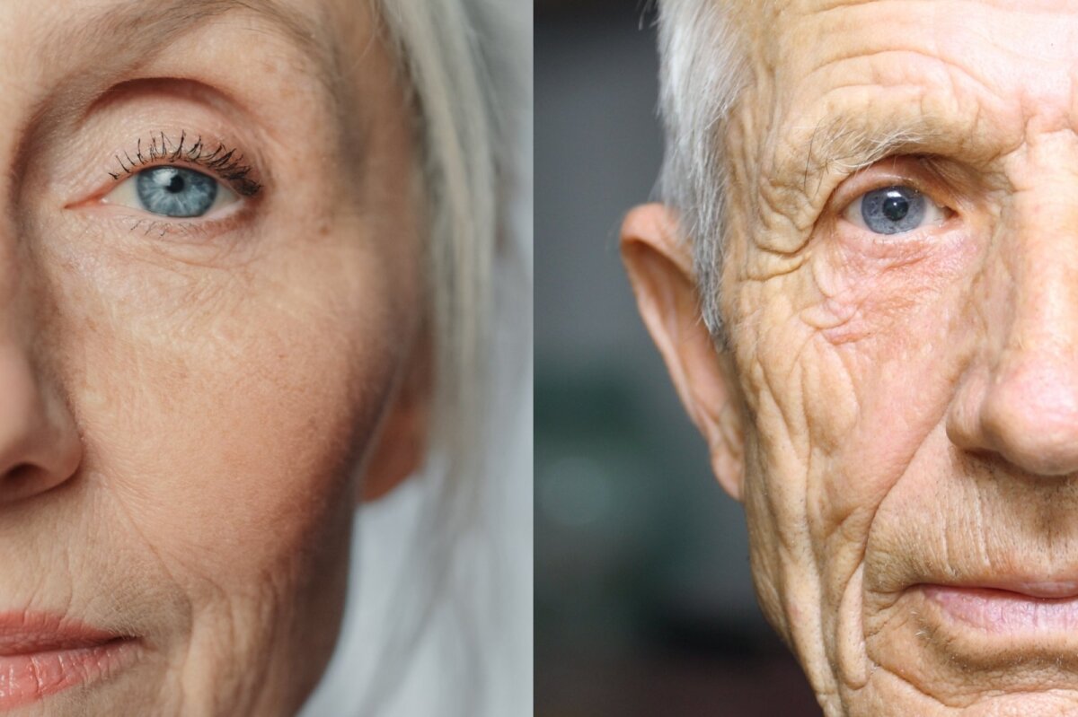 Anti-aldringsteknikk har forynget hudceller i 30 år