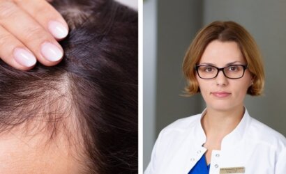 Gydytoja atsakė į klausimus apie plaukų slinkimą: kada verta sunerimti ir kokios priemonės galėtų padėti
