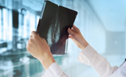 Vėžio dienoraštis. Jau pažengusią žmonos ligą pastebėjo sutuoktinis: ženklai, kurių jokiu būdu negalima ignoruoti