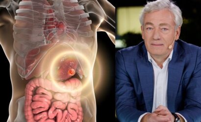 Lietuvoje kasmet nustatoma daugiau nei 800 naujų šio vėžio atvejų – onkologinė liga dažniau diagnozuojama vyrams