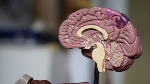 Žmogaus smegenys