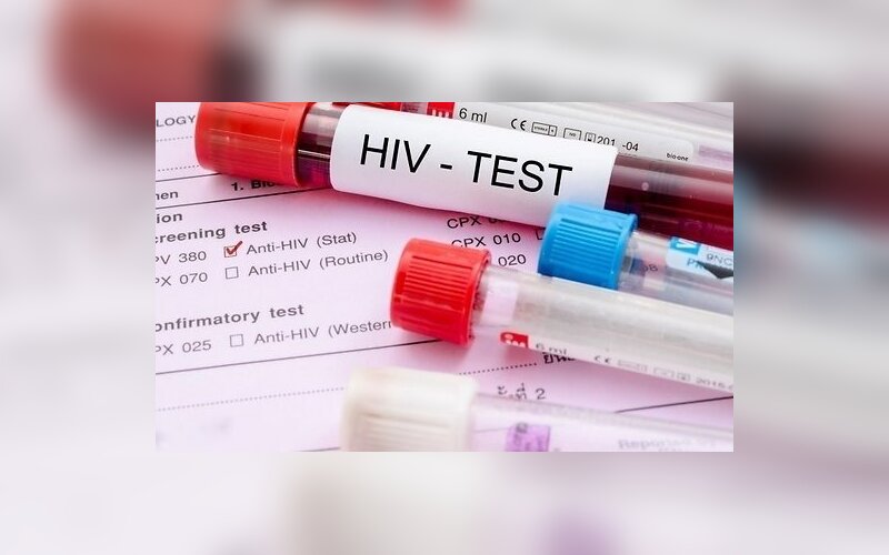 AIDS