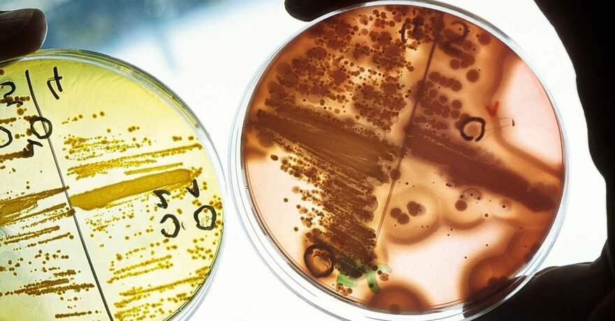 bakterijos
