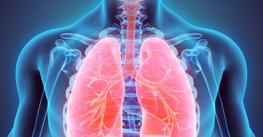 Plaučių embolija