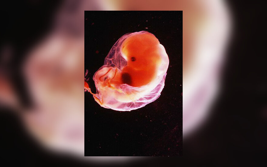 Žmogaus embrionas