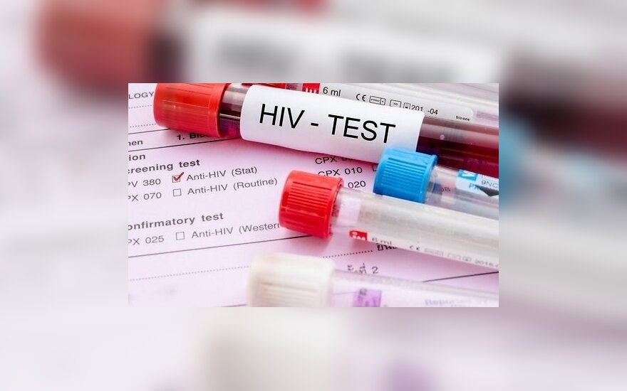 Minint pasaulinę AIDS dieną Seimo nariai tikrinsis dėl ŽIV