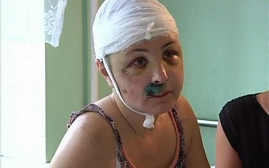 Ukrainoje brutaliai grupiniu būdu išžaginta moteris