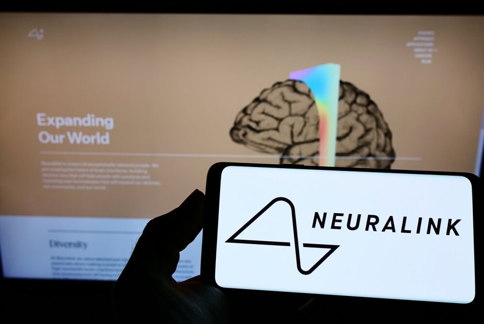 „Neuralink“ kuria smegenų implantus, kurie susietų žmones su kompiuteriu